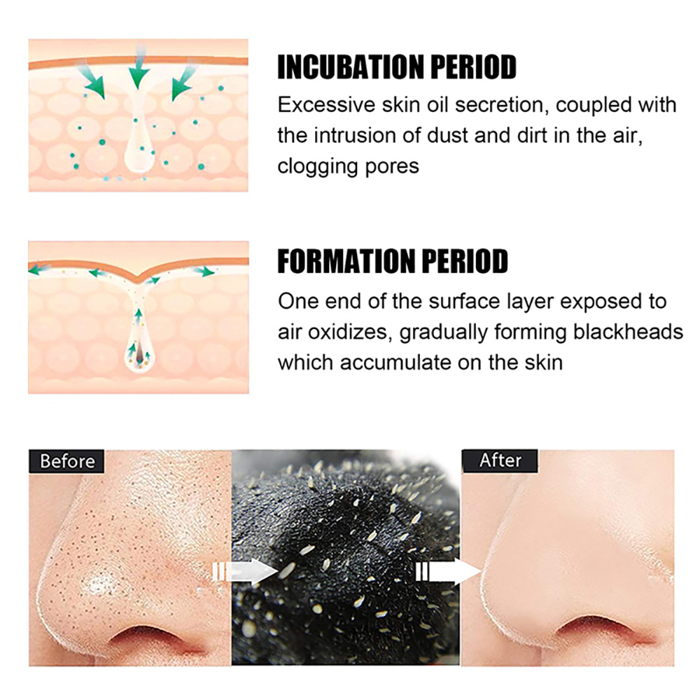 10-100 Unidades de Mascarillas - Nasal Aspirator reseña y precio